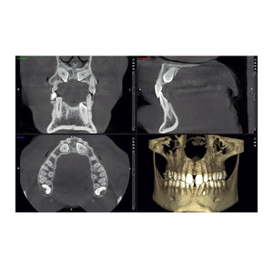 DICOM Viewer Software Module