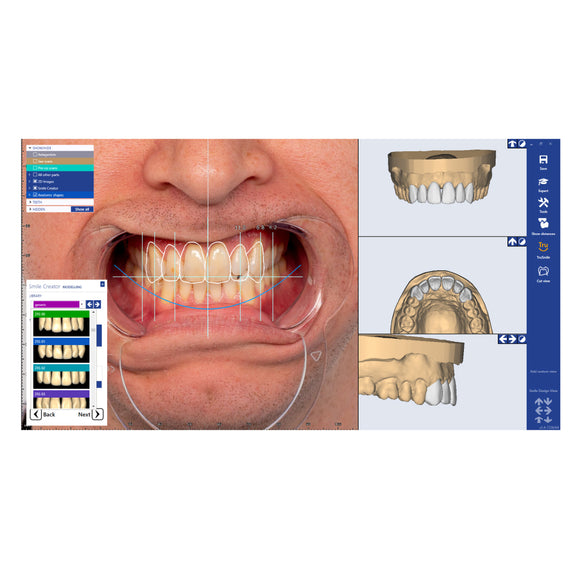 ZRS Tooth Library Software Module